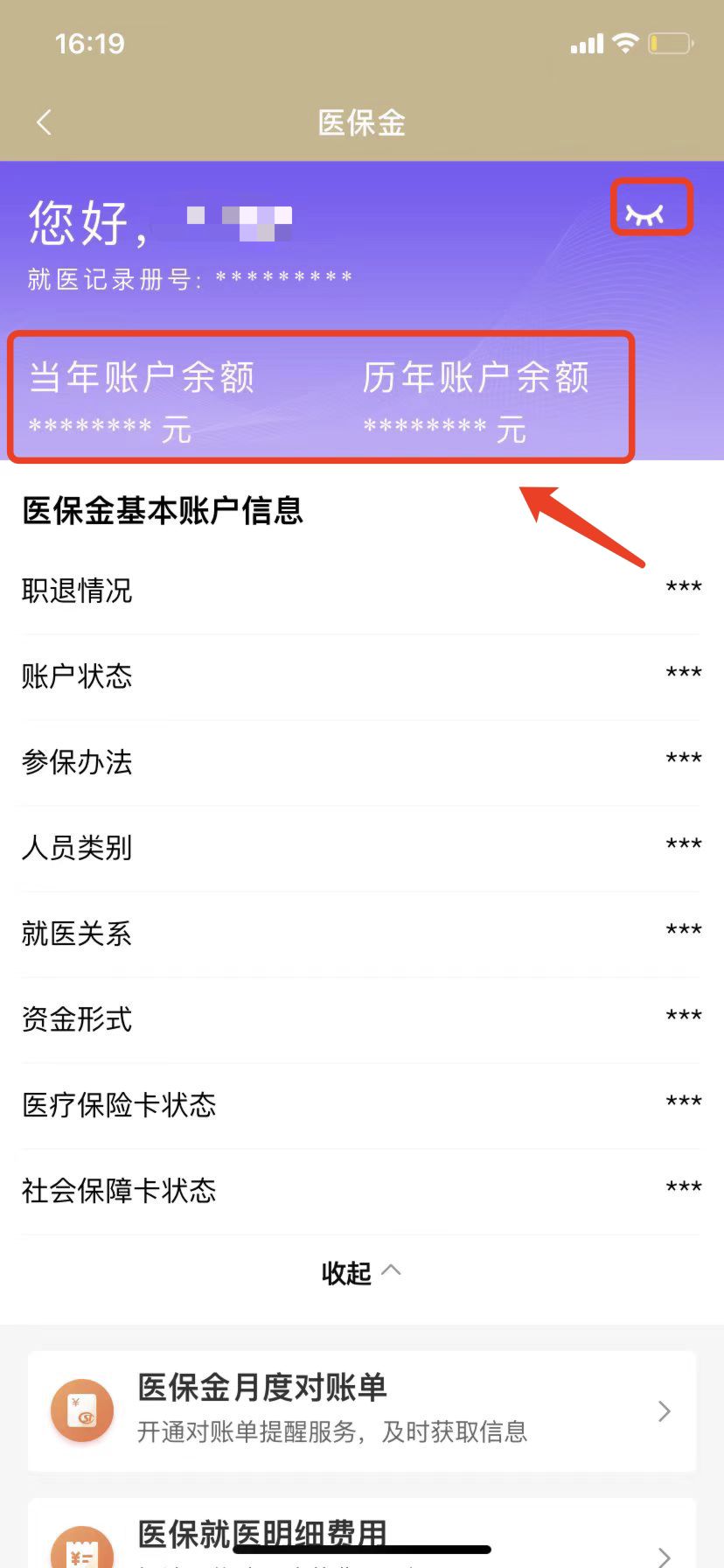 东阳最新钱转到医保卡里还能取出来吗方法分析(最方便真实的东阳医保的钱转到银行卡方法)